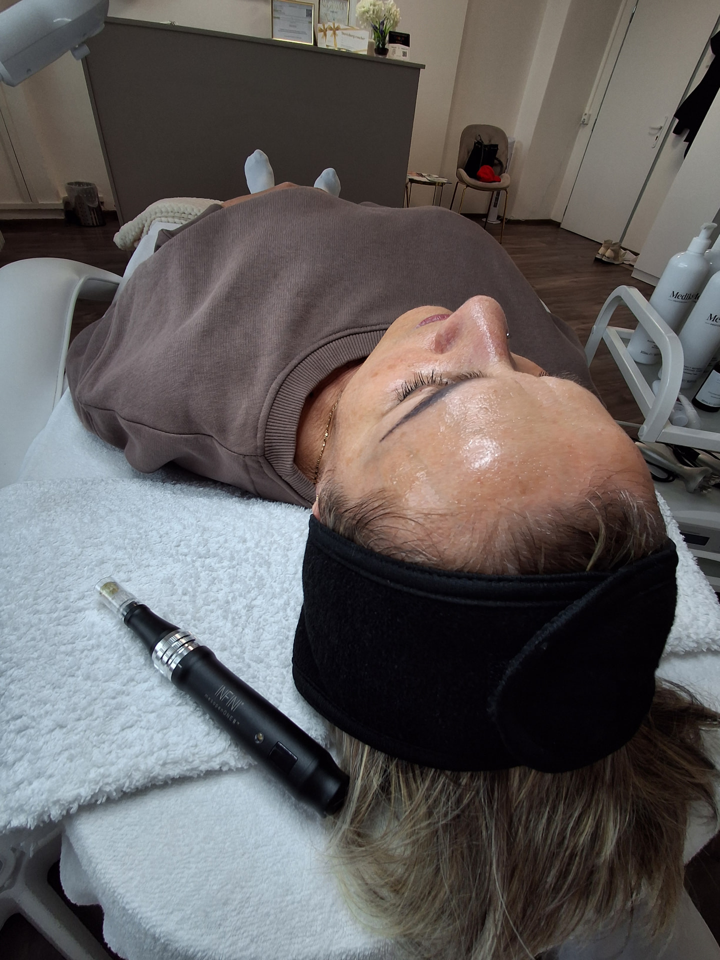 Mikroihličková mezoterapia s prístrojom